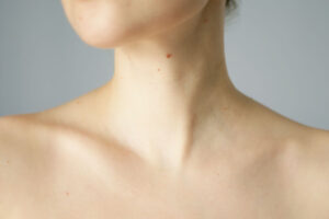 脖子長痘痘：皮脂分泌與身體內分泌的微妙連結